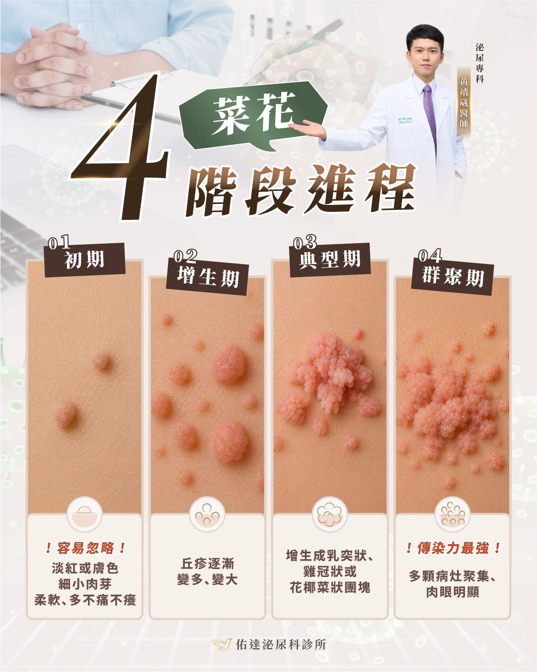 菜花 4 階段進程圖解：初期細小肉芽、增生期變多變大、典型期花椰菜狀團塊、群聚期傳染力最強